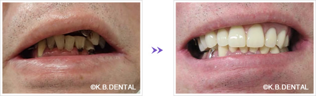 口元：術前術後