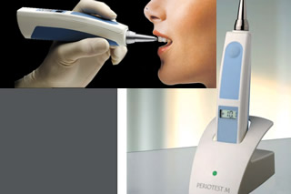 ペリオテストm
