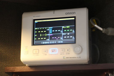 生体情報モニター