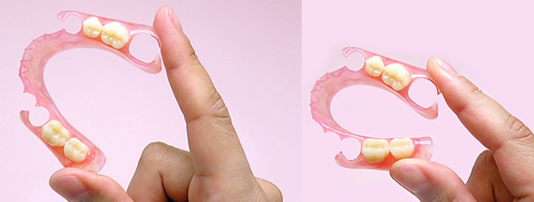 ノンクラスプデンチャー