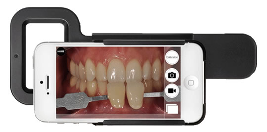 審美歯科用カメラ