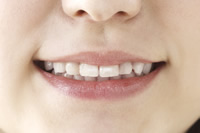 噛み合わせ装着