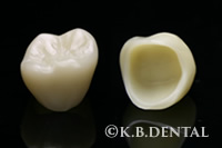 フルジルコニアクラウン