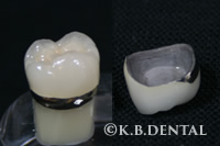 ハイブリッドクラウン