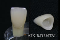 ハイブリッドクラウン