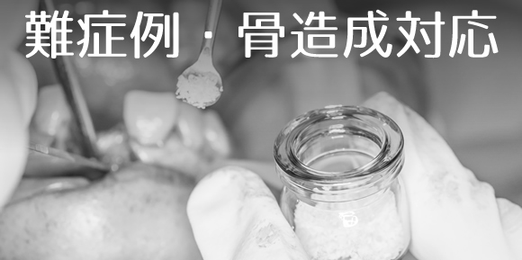 骨造成・再生治療