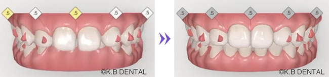 3Dシミュレーション