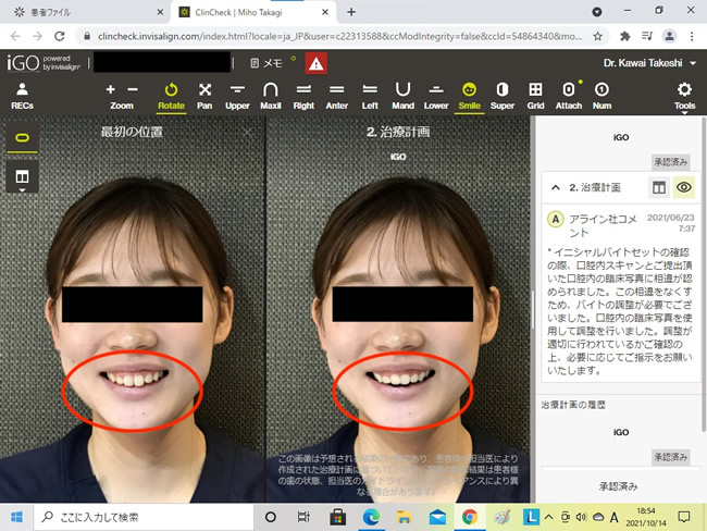 顔貌シミュレーション