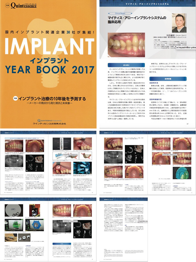 インプラントYEAR BOOK 2017