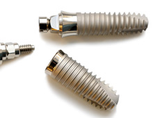 チタンインプラント