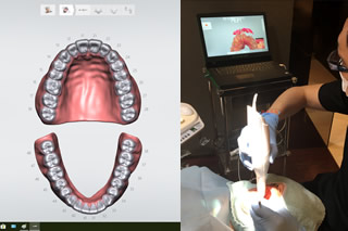 光学スキャナー