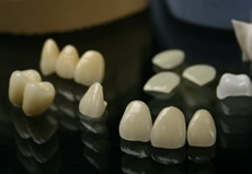 セラミック治療