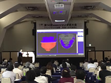 マイティスナビゲーションシステムを用いたフルデジタルワークフロー2