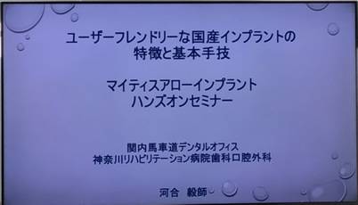 ユーザーフレンドリーな国産インプラントの特徴と基本手技