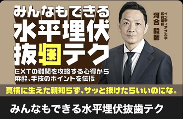 みんなもできる水平埋伏抜歯テク