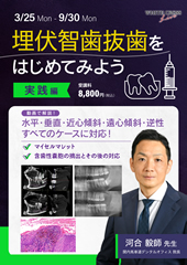 埋伏智歯抜歯をはじめてみよう実践編