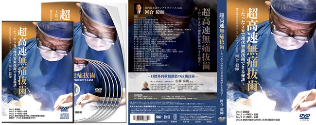 超高速無痛抜歯DVD