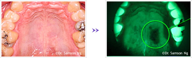照射によるガン検診の様子