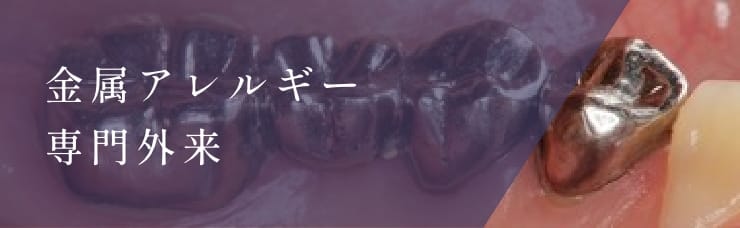 金属アレルギー専門外来